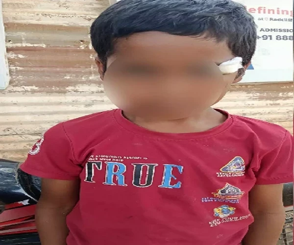 Raipur News: क्लास में पढ़ रहे छात्र पर गिरा सीलिंग फैन, 10 वर्षीय बच्चे की आंख में गंभीर चोट
